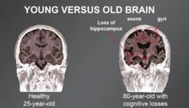 Brain old
